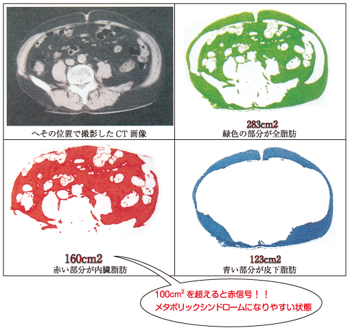 メタボリックシンドロームになりやすい状態