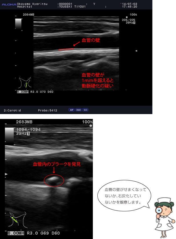 頚部・甲状腺エコー検査